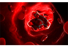 The Disease Susceptibility Genetic Test-APOE